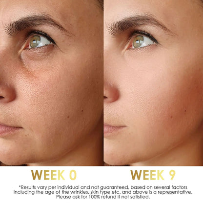 Organic Bakuchiol Serum - Face Serum | Anti-Aging Cream and Antioxidant Serum